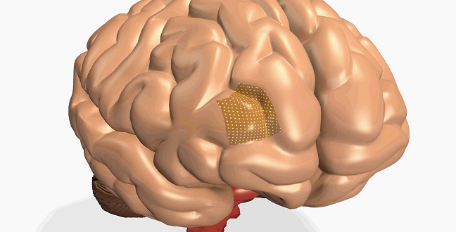CEMSE EE Gentle Sensors For Diagnosing Brain Disorders
