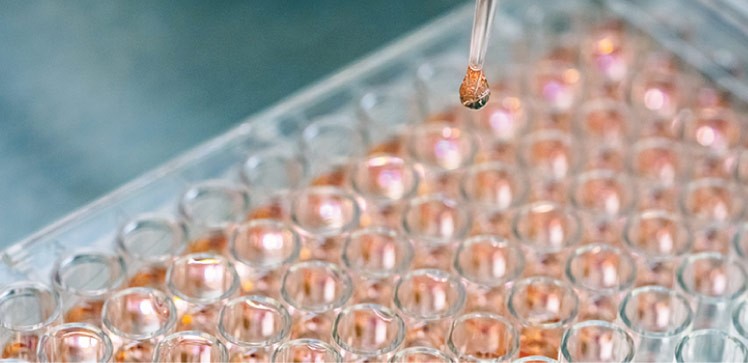 Bioreactor keeps cell culture conditions under control