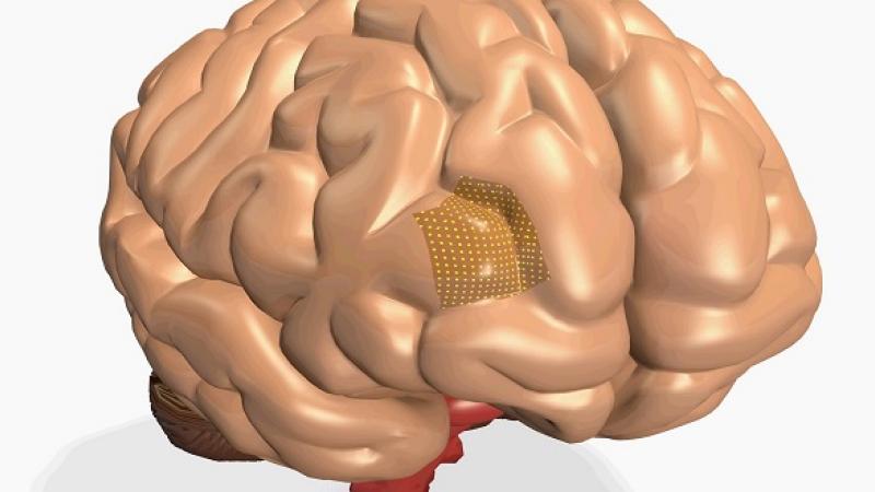 CEMSE EE Gentle Sensors For Diagnosing Brain Disorders